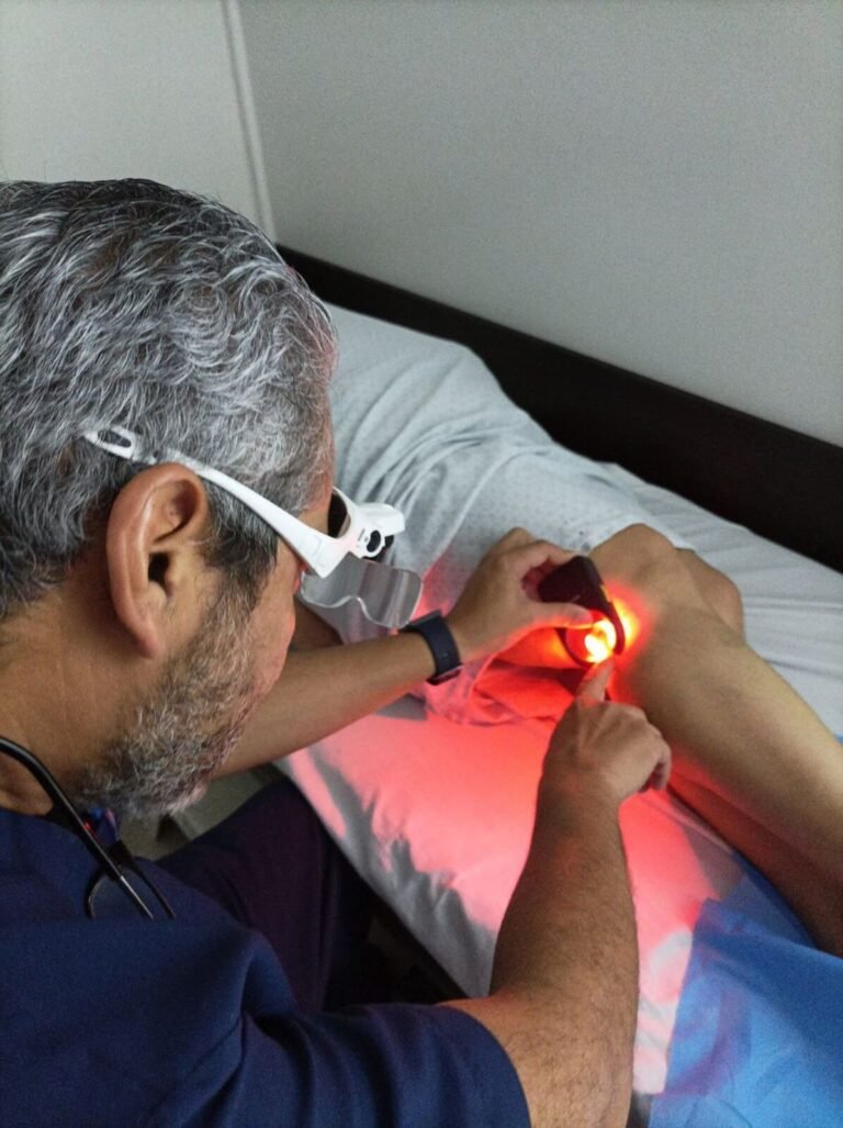 Beneficios de la escleroterapia para arañas vasculares – Resultados visibles, piernas renovadas