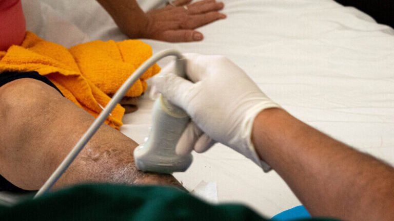 Úlceras venosas en las piernas: ¿Por qué no sanan y cómo tratarlas?